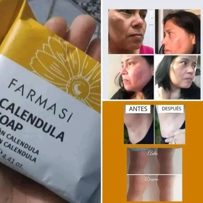 Jabón de caléndula  /venta en USD's photo #1